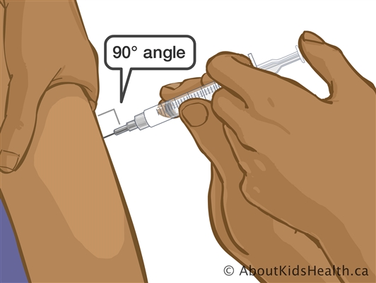Na jehle: o způsobu injekce
