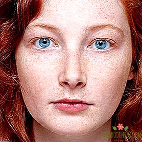"Skönhetsgen": Redheads som utrotningshotade arter