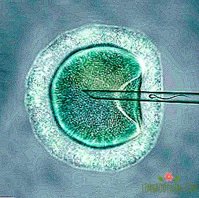 מ מבחנה למשלוח: איך ולמה לעשות IVF