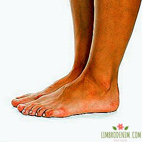 Flatfoot: Skąd pochodzi i czy go leczyć