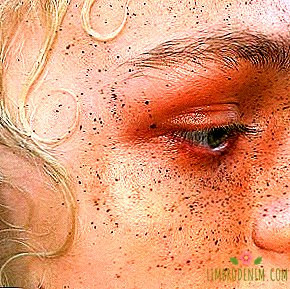 Freckles: labiausiai pavasario makiažas
